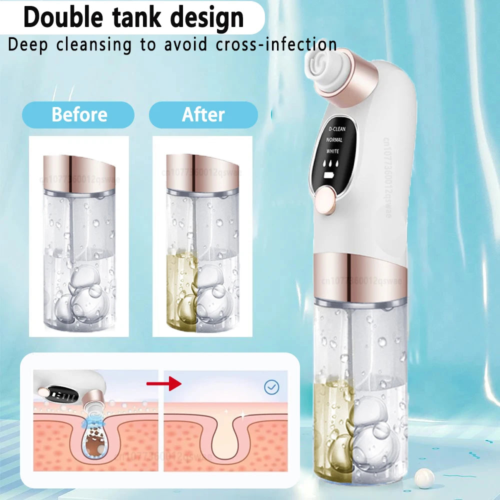 Deep Cleansing Blackhead Remover with Water Cycle Technology – Deep Pore Cleansing & Skin Care Vacuum for Blackheads and Acne