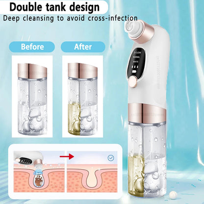 Deep Cleansing Blackhead Remover with Water Cycle Technology – Deep Pore Cleansing & Skin Care Vacuum for Blackheads and Acne