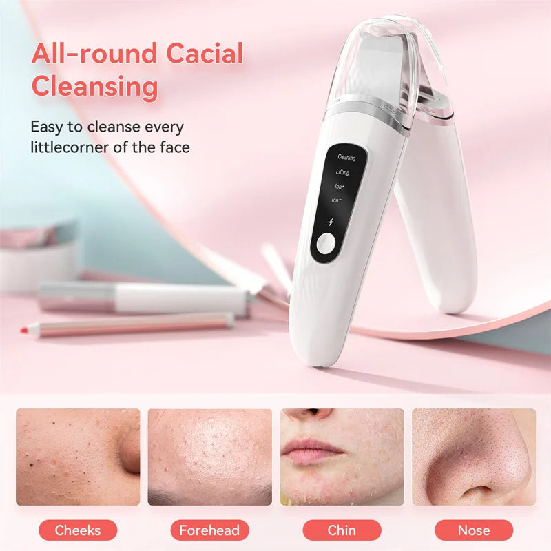 UltraSonicSkin™ Facial Skin Scrubber & Blackhead Remover – Ultrasonic Exfoliator and Pore Cleaner