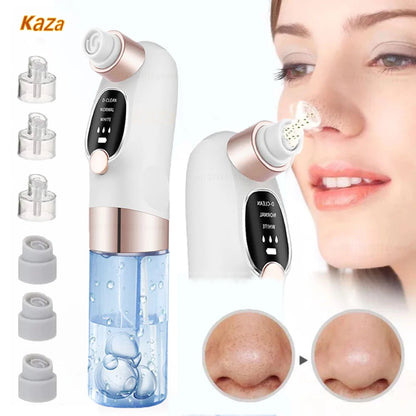 Deep Cleansing Blackhead Remover with Water Cycle Technology – Deep Pore Cleansing & Skin Care Vacuum for Blackheads and Acne