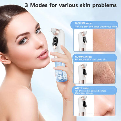 Deep Cleansing Blackhead Remover with Water Cycle Technology – Deep Pore Cleansing & Skin Care Vacuum for Blackheads and Acne