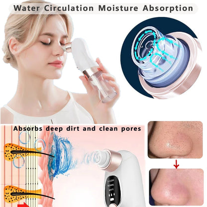 Deep Cleansing Blackhead Remover with Water Cycle Technology – Deep Pore Cleansing & Skin Care Vacuum for Blackheads and Acne