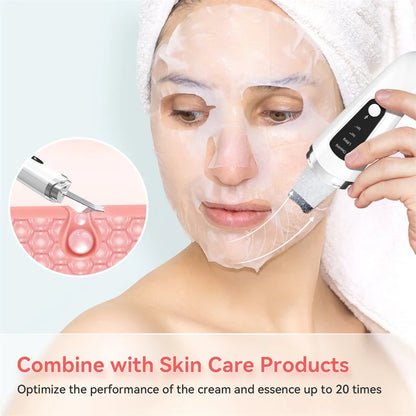 UltraSonicSkin™ Facial Skin Scrubber & Blackhead Remover – Ultrasonic Exfoliator and Pore Cleaner